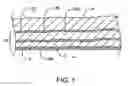 Fig. 02 - Methods and kits for volumetric distribution of pharmaceutical agents via the vascular adventitia and microcirculation