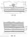 Fig. 04 - Methods and kits for volumetric distribution of pharmaceutical agents via the vascular adventitia and microcirculation