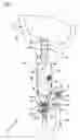Fig. 02 - Pressure activated IV set