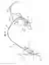 Fig. 09 - Nasogastric tube insertion system and method