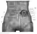 Fig. 01 - Ostomy support garment