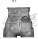 Fig. 02 - Ostomy support garment