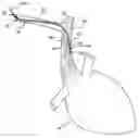 Fig. 01 - High flow diffusion catheter