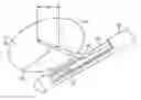 Fig. 01 - Method and device for uterine fibroid treatment