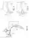 Fig. 03 - Method and device for uterine fibroid treatment