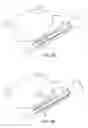 Fig. 06 - Method and device for uterine fibroid treatment