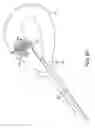 Fig. 20 - Method and device for uterine fibroid treatment
