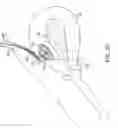 Fig. 22 - Method and device for uterine fibroid treatment