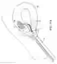 Fig. 23 - Method and device for uterine fibroid treatment