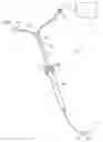 Fig. 01 - Methods and apparatus for coagulating and/or constricting hollow anatomical structures