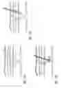 Fig. 09 - Methods and apparatus for coagulating and/or constricting hollow anatomical structures