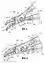 Fig. 04 - Vessel sealing instrument