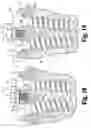 Fig. 07 - Anterior cervical plating system