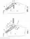 Fig. 06 - Graft anchor