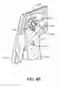 Fig. 06 - Rongeur that disassembles for cleaning