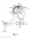 Fig. 02 - Apparatus and methods for applying neural stimulation to a patient