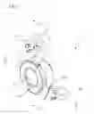 Fig. 02 - Internal adaptor for hip acetabular cage
