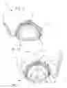 Fig. 08 - Internal adaptor for hip acetabular cage