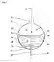 Fig. 02 - Plate package