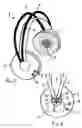 Fig. 02 - Cordless headphone