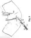 Fig. 07 - Transobturator surgical articles and methods