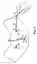 Fig. 09 - Transobturator surgical articles and methods