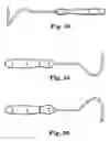 Fig. 35 - Transobturator surgical articles and methods
