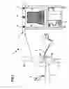 Fig. 02 - Method and apparatus for determining the angle between the femur and the tibia