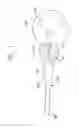 Fig. 02 - Urethral profiling device & methodology