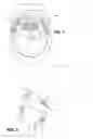 Fig. 02 - System and method for treatment of uvula and soft palate to reduce tissue laxity