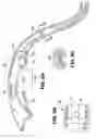 Fig. 09 - Electrosurgical hemostat