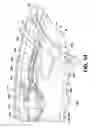 Fig. 12 - Electrosurgical hemostat