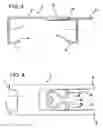 Fig. 03 - Sternum closure device having locking member