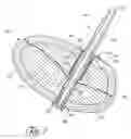 Fig. 02 - Proximal anchors for bone fixation system