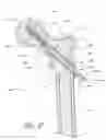 Fig. 07 - Proximal anchors for bone fixation system