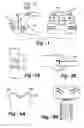 Fig. 02 - Joint replacement methods and apparatus
