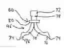 Fig. 01 - Vascular sheath with bioabsorbable puncture site closure apparatus and methods of use
