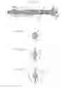 Fig. 08 - Balloon catheter