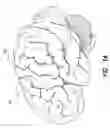 Fig. 02 - Methods and systems for stimulating a motor cortex of the brain to treat a medical condition