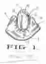 Fig. 02 - Heart valve system