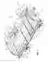 Fig. 02 - Siderail for a hospital bed