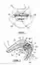 Fig. 02 - Dental device