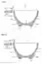 Fig. 06 - Dye cup