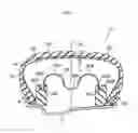 Fig. 02 - RUN-FLAT TIRE SUPPORT, METHOD FOR MANUFACTURING THE SAME, AND RUN-FLAT TIRE