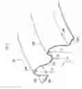 Fig. 03 - RUN-FLAT TIRE SUPPORT, METHOD FOR MANUFACTURING THE SAME, AND RUN-FLAT TIRE