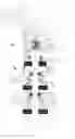 Fig. 01 - System and method for completing a subterranean well