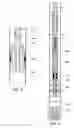 Fig. 07 - Deep water drilling with casing