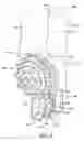 Fig. 04 - Modular kerfing drill bit