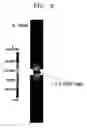 Fig. 07 - Microfluidic device including membrane having nano- to micro-sized pores and method of separating polarizable material using the same