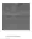 Fig. 06 - PRE-METERED, UNSUPPORTED MULTILAYER MICROPOROUS MEMBRANE